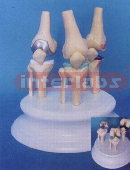 DESK-TYPE, DISEASE MOVABLE JOINTS MODEL WITH ROUND STAND AND DESCRIPTION PLATS